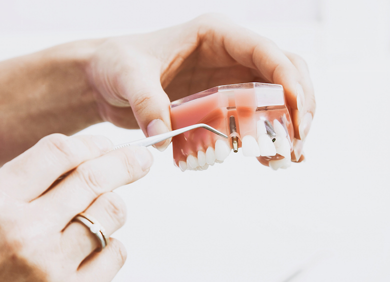 Root Canals and Chronic Disease
